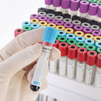 Купить Vacuum EDTA Blood Tubes for Complete Blood Count (CBC) – High Quality, Secure Seal онлайн изготовление